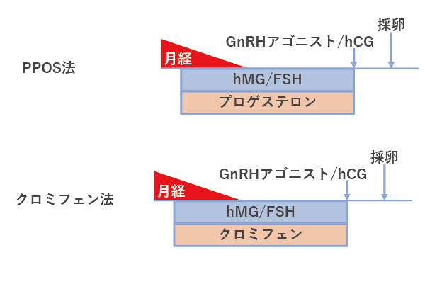 PPOS法、クロミフェン法