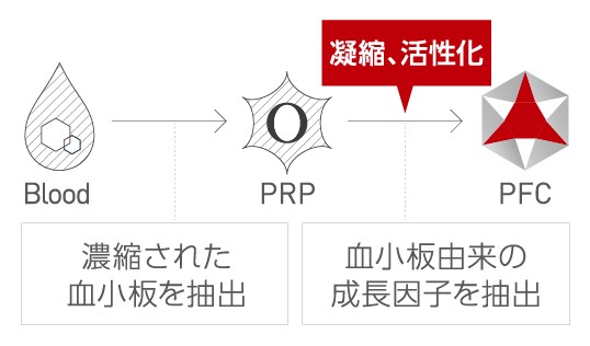 血液から凝縮された血小板を抽出、PRPで血小板由来の成長因子を抽出して、凝縮・活性化を行ったものがPFC